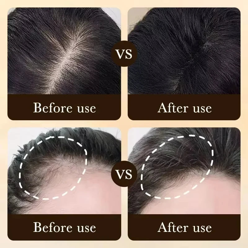Hair Growth Essential Loss Regrowth Treatment Strengthens Hair Nourishes Scalp Light Weight Non Greasy Improve Scalp Circulation
