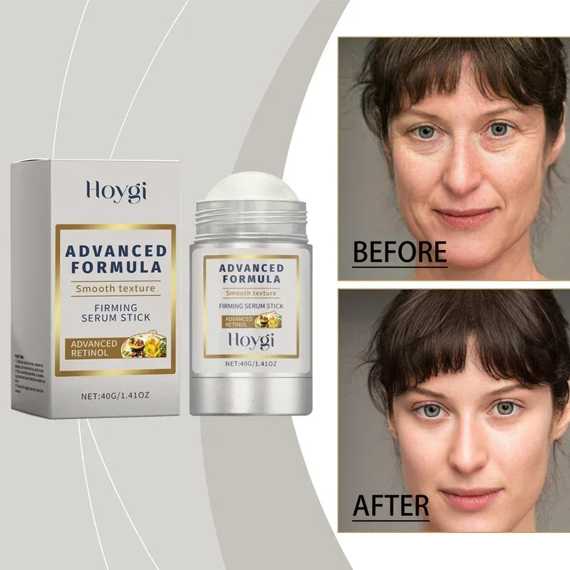 Retinol Hyaluronic Acid Stick Anti Wrinkle Tighten Pores Firming Lifting Plump Skin 24H Moisturizing Anti Aging Korean Care Balm